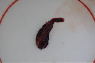 流产出血图片,揭秘其症状与应对措施